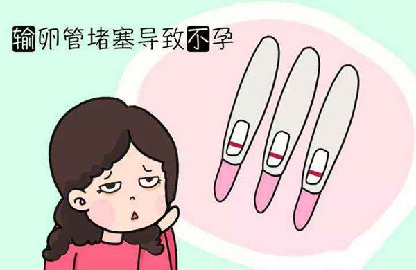 上海助孕多少钱（[助孕攻略大全]输卵管堵塞是不是务必要做试管婴儿）