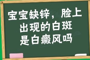 宝宝缺锌脸上出现白斑是白癜风吗