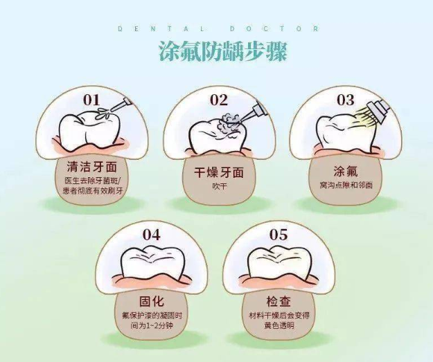 就是由医生把浓度相对较高的氟化物涂到牙齿表面,以增强牙齿防龋的
