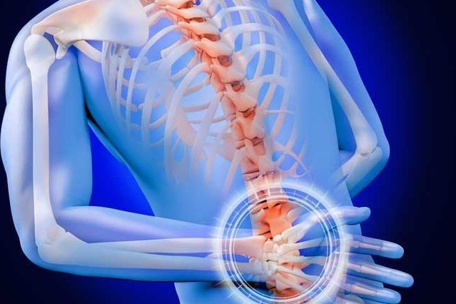 骶髂关节炎与强直有什么关系?是否就是强直性脊柱炎早期