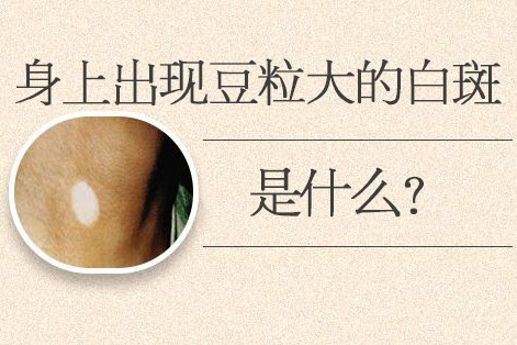 身上皮肤有豆粒大的白斑需要治疗吗?白癜风科室邱效坤