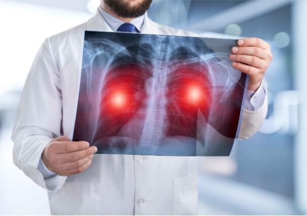 长期吸烟者,胸背出现异常疼痛,需重视,或是肺癌发出的