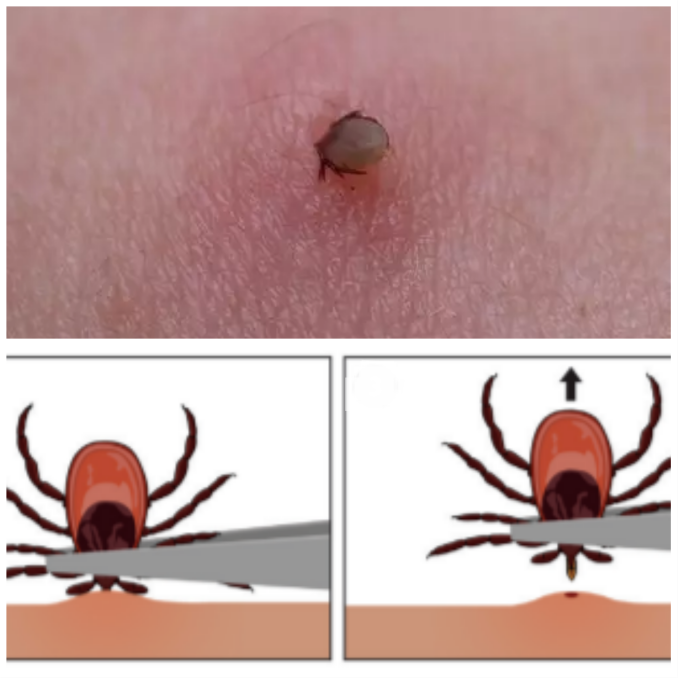定期检查一下你的宠物身上是否有蜱,防止蜱虫通过动物叮咬人.