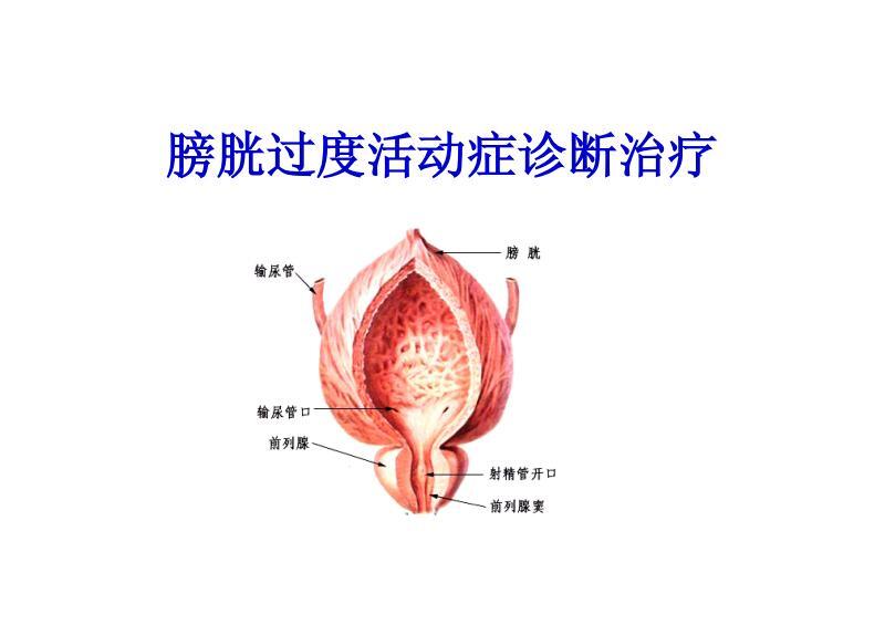 间质性膀胱炎(ic)