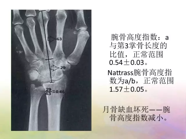 基础学习 腕关节解剖详解