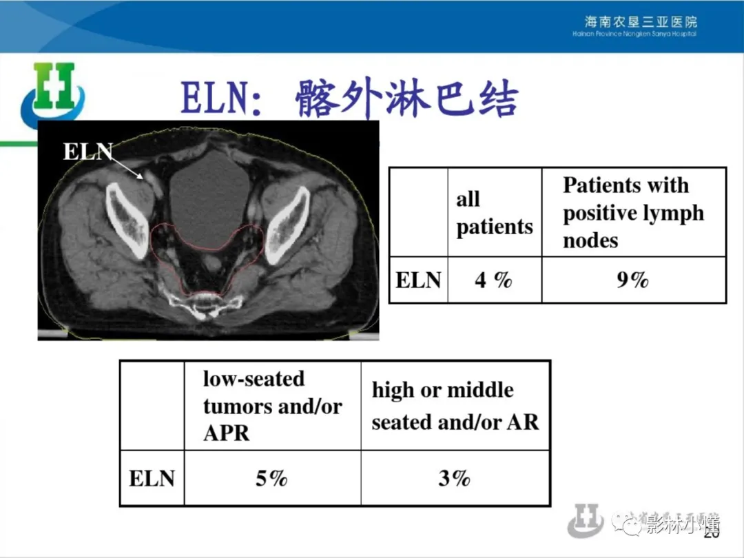 盆腔淋巴结的影像解剖及临床应用