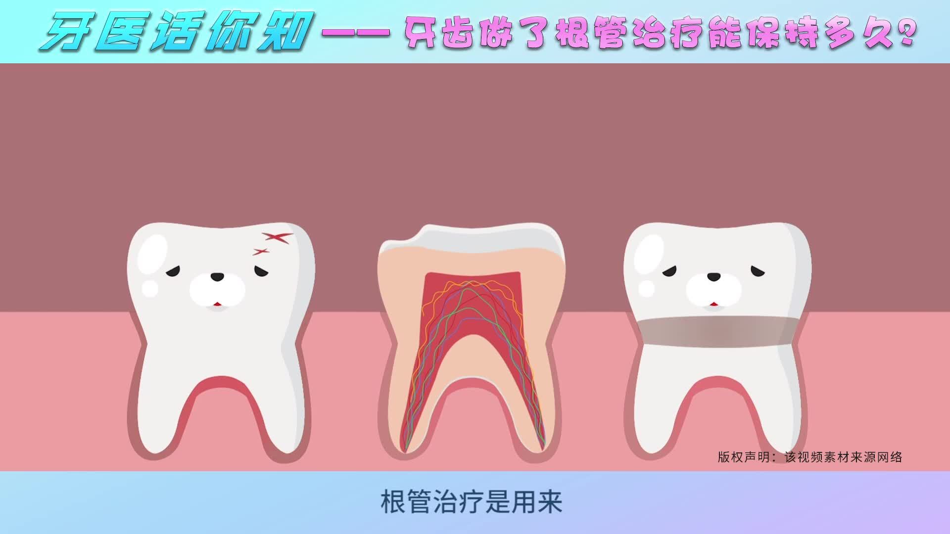 牙齿做了根管治疗能保持多久