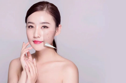 做完果酸换肤出现烂脸怎么办？医美专家建议试试这个方法