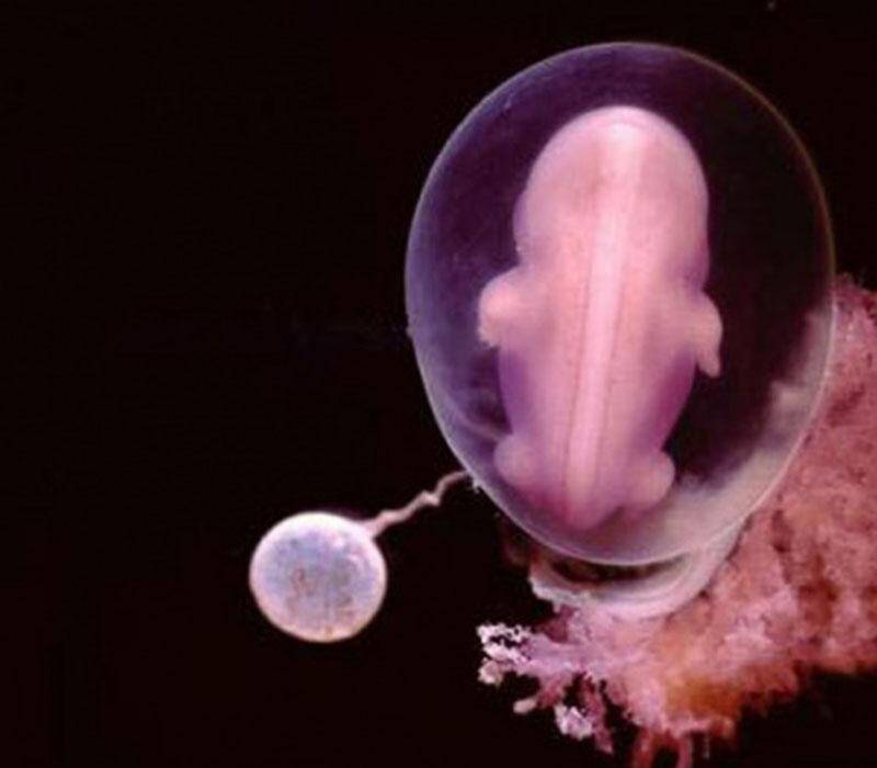 当精子与卵子相遇时,一组照片展示生命如此神奇伟大!