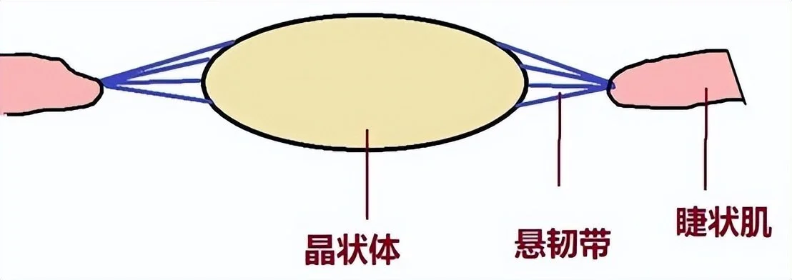 源于信任，合肥普瑞成为家族六人“晶状体脱位”后的坚定选择(图6)