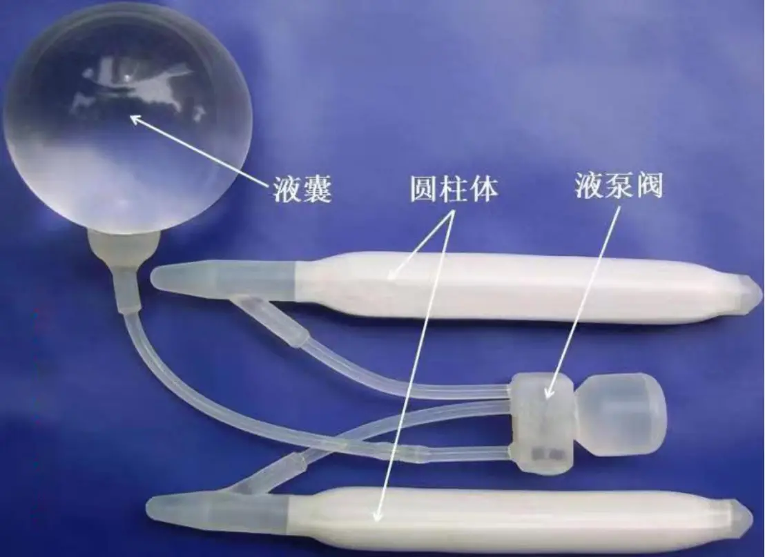 湖南中医药大学第一附属医院成功开展阴茎假体植入手术(图2)