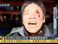 台湾有示威学生流血受伤 高喊“警察打人”