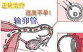 输卵管堵塞,哪个才是真正“元凶”?