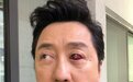 57岁庾澄庆心态太好，眼睛受伤还自嘲是火眼金睛