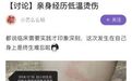 热水袋烧伤案例终身难忘,这种处理方法赶紧收藏~