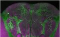 Science:重磅!新研究发现一个在患病时促进睡眠的基因