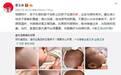 这8种疹子你分得清吗?用错药,小心越治越糟!(附超强图解)