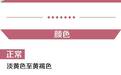 3分钟,学会看体检的尿液检查报告!