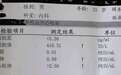 如何读懂乙肝五项检查报告信息?