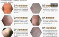 生活中比较常见的荨麻疹为什么会重复发作