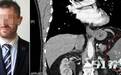 男子体内长西瓜大的肿瘤,手术后成无敌金刚,医生竟用水泥填充