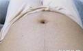 怀孕期间, 准妈妈肚皮长毛会生男孩? 来看看医生怎么说