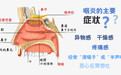 咽炎是怎么回事