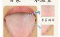 为什么老中医要看你的舌头?舌头原来是人体健康的“放大镜