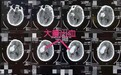 男子高危大量脑出血陷昏迷,医生微创“小孔径”手术化险为夷