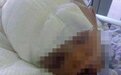 5岁女孩取快递被陌生女子暴打 警方:打人者已被刑拘