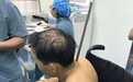 男子高空坠落遭1米长钢筋穿身 4小时抢救后成功脱险
