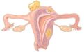 The Lancet:法国首个接受子宫移植的女性成功诞下婴儿