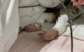 心疼!渭南一岁宝宝坐进开水盆,半身大面积烫伤……