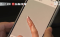 长时间握手机导致小拇指变形?医生解释来了