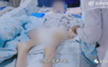 15岁广东少女减肥致死!体重仅24公斤,50天不吃饭患严重厌食症,呼吸衰竭太可怜…