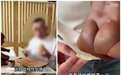 土豆片贴痔疮,又有医生科普翻车