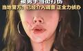 男子要微信被拒殴打两女孩致流血?警方:正在调查,稍后通报