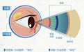 郑州爱尔眼科医院韩红琳医生科普:干眼会影响视力会影响视力吗?