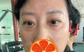 重拾自信笑容,郭鑫医生助您告别眼袋,泪沟填充焕发新生