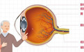 眼睛的血管也会“塞车”?这些人尤其需注意——合肥爱尔