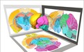 微米级“脑地图”来了!我国科学家在脑图谱研究领域取得新突破