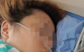 甘孜党岭女游客仍在ICU,首拨驴友还原救援过程:网上的“全女徒步”为假