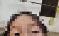 5岁女童被机器人踢掉4颗牙、面部缝3针,家属索赔15万元