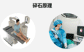 结石别乱碎!不当碎石易伤肾,这些误区务必避开|成都碎石专科医院