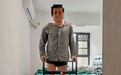 男子双大腿被绞断完全分离,经手术重新“接”回