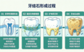 健康|一个滂臭的脏东西,天天刷牙都刷不掉,还会诱发致命疾病