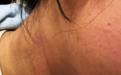 每天一杯奶茶,17岁女生脖子越来越黑,医生:是这里在报警