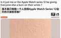 部分苹果Apple Watch Series 12/Ultra 4用户报告皮肤刺激情况