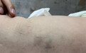 咸阳一新生儿遭月子中心护工拍打案一审裁定:涉嫌虐待,移送公安