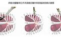 术锐股份拟科创板IPO:单孔腔镜手术机器人产品具有先发优势,清华学子创办,先进制造基金持股